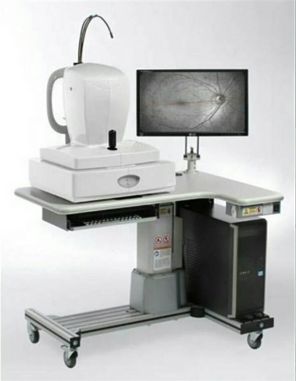 光学相干断层扫描(OCT)